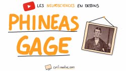 Vignette de L'INCROYABLE M&Eacute;SAVENTURE DE PHINEAS GAGE - Les neurosciences en dessins